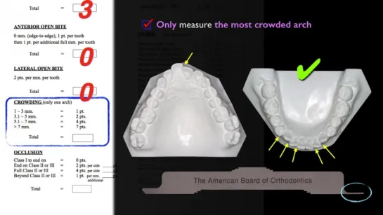 2017 ABO Discrepancy Index (DI) by Chris, Angle Lee Part 3. Ортодонтия.