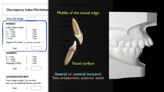 Discrepancy Index (DI) Part 3. Ортодонтия.