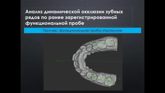 Регистрация артикуляции н-ч. Гнатология.