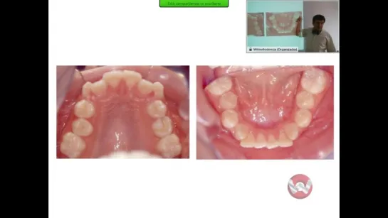 Cómo diagnosticar en ortodoncia. Ортодонтия.