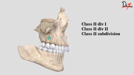 Angles classification  MALOCCLUSION. Гнатология.