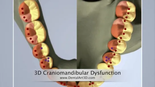 DentalArt3D. 3D Craniomandibular Dysfunction. Гнатология.