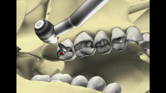 Equilibration. Гнатология.