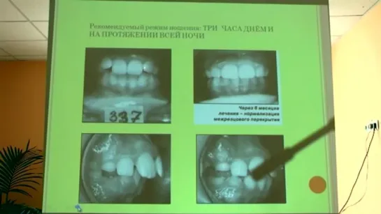 Ортодонтия лечит сколиоз и артроз. Анисимова Н.А