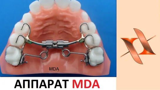 Ортодонтический аппарат MDA.