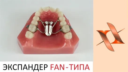 Ортодонтический экспандер Fan - типа. Ортодонтия.