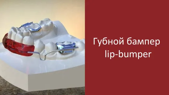 Губной бампер - lip-bumper. Ортодонтические аппараты.