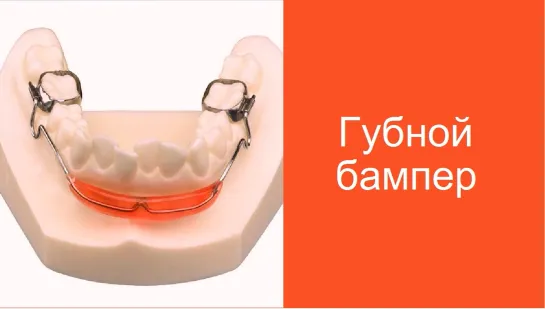 Lip Bumper. Губной бампер. Биомеханика. Активация.Ортодонтия.