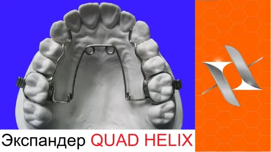 Ортодонтический аппарат Квадхеликс. Оrthodontic appliance Quad Helix.