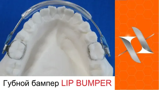 Ортодонтические аппараты. Губной бампер.Lip bumper