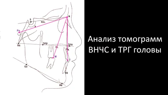 Анализ томограмм ВНЧС и ТРГ головы. Пропедевтика ортодонтии МГМСУ. Стоматология