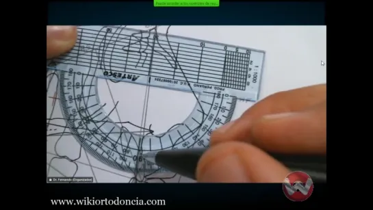 Cefalometría de Ricketts II. Ортодонтия.