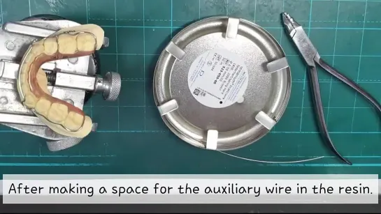 Auxiliary wire repair method of wraparound retainer guide wire repair. Ортодонтия.