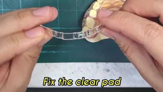 Connecting the clear pad to the retainer. Зуботехническая работа. Ортодонтия.