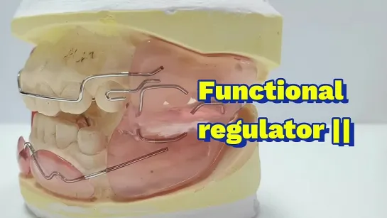 Functional regulator  Frankel appliance II. Зуботехническая работа. Ортодонтия.