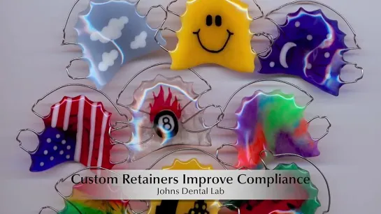 Retainer Designs Johns Dental Lab. Зуботехническая работа.