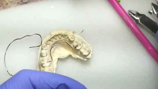 How to add Guide Wires onto Retainers by Szara Dental. Часть 2. Ортодонтия.