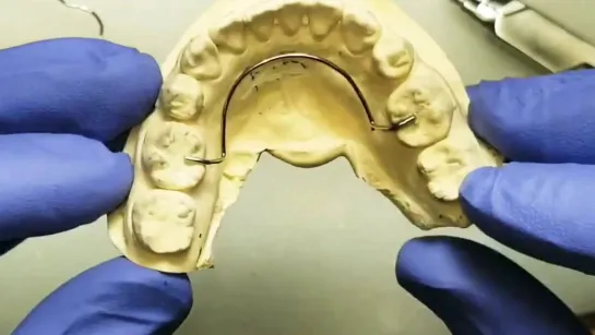 HOW TO BEND A LINGUAL RETENTION ARCH. Зуботехническая работа.