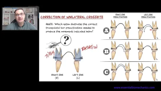 Unilateral Crossbite Correction  - Essential Biomechanics