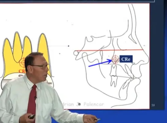 Dr. Adrian Palencar - Case Finishing. Ортодонтия.