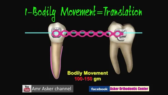 Types of Orthodontic Tooth movement-Asker Orthodontic Center,,,Amr Asker Orthodontics