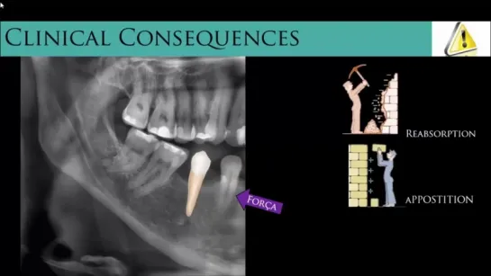 IDEAL ORTHODONTIC FORCE. Ортодонтия.