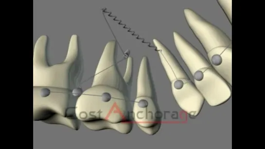 Vertical dimension and protrusion correction.Ортодонтия.Брекеты.