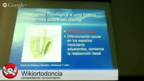 Fisiología del movimiento dentario. Ортодонтия.