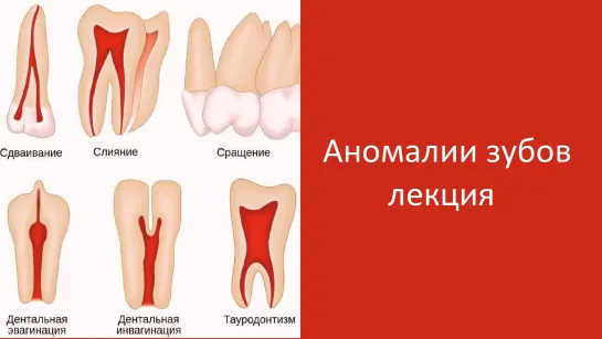 Аномалии зубов. Лекция Колесник К.А. Стоматология.