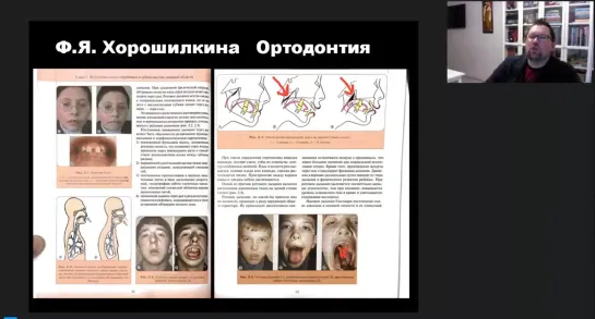 Все о дыхательных путях, часть 1. С. Блум. Ортодонтия