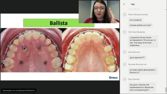 Вебинар ORMCO. Анна Бадмаева 16.10.18 - Особенности ведения пациентов с ретенцией клыков