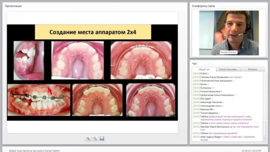 Вебинар ORMCO: Выбор торка брекетов при работе Damon System. Ортодонтия.