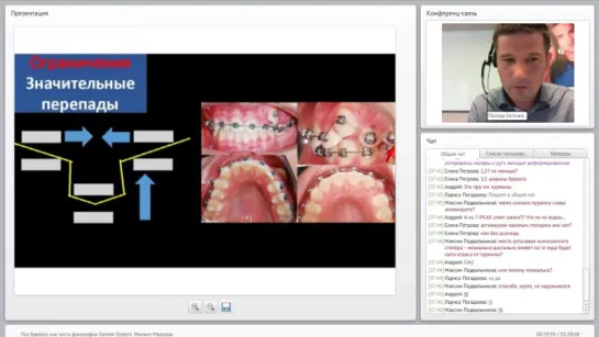 ORMCO. Запись вебинара Михаила "Морозова Паз брекета как часть философии Damon", 04.10.17