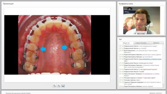 Вебинар ORMCO: Лечение без удаления в Damon System. Михаил Морозов. Ортодонтия.