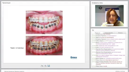 Запись вебинара ORMCO Детская ортодонтия. Вредные привычки., М.Дубовская