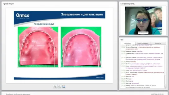 Дуги Ормко - особенности применения Вебинар ORMCO. Ортодонтия. Брекеты.