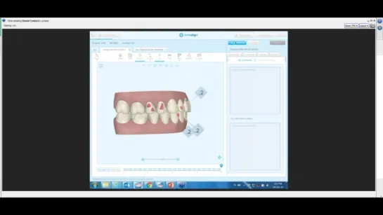 INVISALIGN. Презентация для ортодонтов. Вебинар 2016 - English version с русским переводом.Ортодонтия.