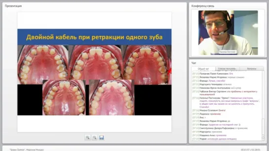 Трюки Damon. Ортодонтия. Брекеты. Вебинар ORMCO.