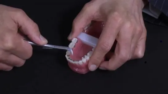 USING LINGUAL PLIERS IN ORTHODONTICS. Ортодонтия.