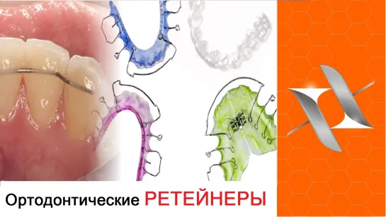 Ретейнеры. Ортодонтия. Various orthodontic Retainers #1.Стоматология.