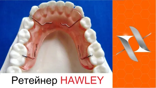 Ортодонтический ретейнер. Hawley Retainer. Оrthodontic appliance