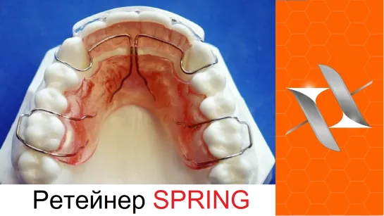 Ортодонтический ретейнер - Spring Retainer. Оrthodontic appliance.