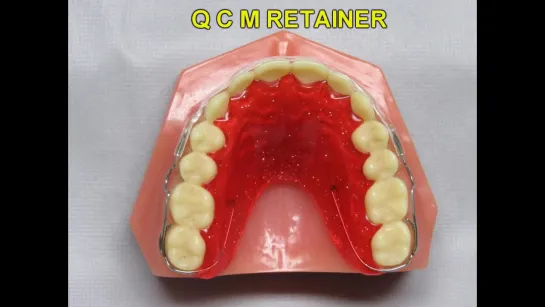 FINAL ORTHODONTIC RETAINERS AFTER BRACES OR INVISALIGN. Ортодонтия