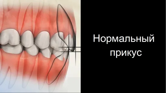 Нормальный прикус. Пропедевтика стоматологии.