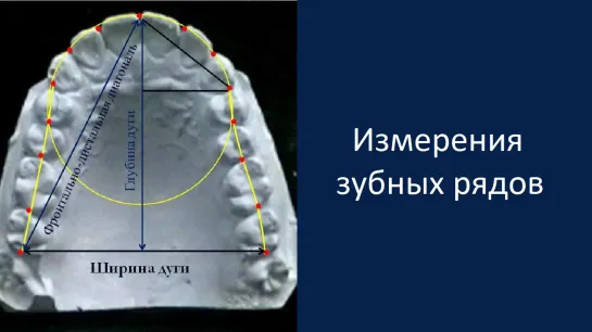 Измерения зубных рядов. Пропедевтика ортодонтии. МГМСУ. Стоматология