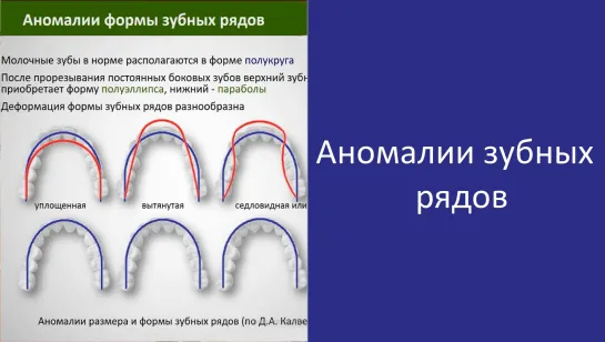 Аномалии формы и размеров зубных рядов.Пропедевтика ортодонтии. МГМСУ Стоматология