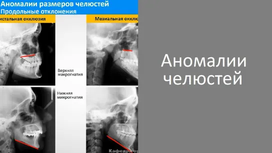 Аномалии челюстей. Пропедевтика ортодонтии. МГМСУ. Стоматология