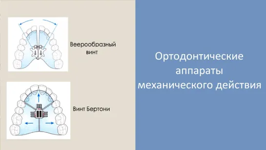 Ортодонтические аппараты механического действия. Пропедевтика МГМСУ. Стоматология