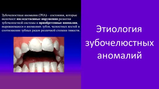 Этиология зубочелюстных аномалий. Пропедевтика МГМСУ. Стоматология