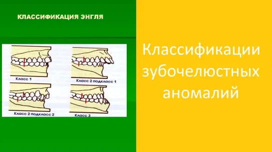 Классификации зубочелюстных аномалий.Пропедевтика.МГМСУ. Стоматология